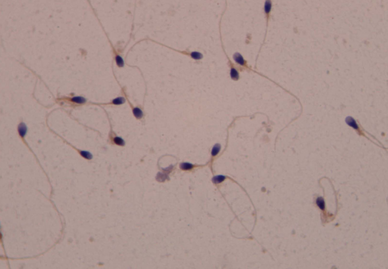 Procesamiento de Imágenes Médicas